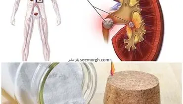 بهترین روش برای بهبود عملکرد کلیه‌ها