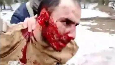 بازداشت سومین عامل حمله تروریستی در مسکو با چهره ای خون آلود+ فیلم