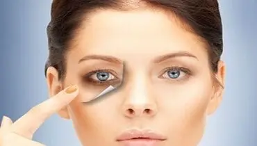 علت سیاهی زیر چشم چیست؟