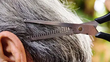 علت سفیدی مو چیست