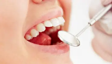 تاثیر باکتری‌های دهان بر سلامت ریه‌ها