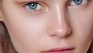 روش‌های طبیعی برای درمان پوست چرب