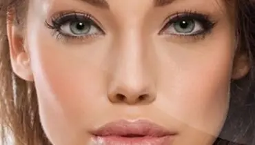 داشتن گونه‌هایی برجسته، بدون عمل جراحی