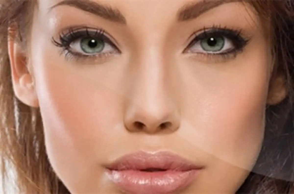 داشتن گونه‌هایی برجسته، بدون عمل جراحی