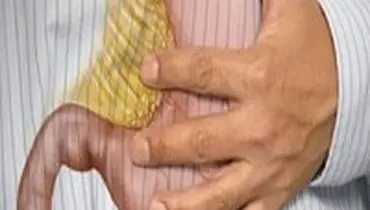 نسخه بسیار قوی طب سنتی برای درمان "زخم معده"
