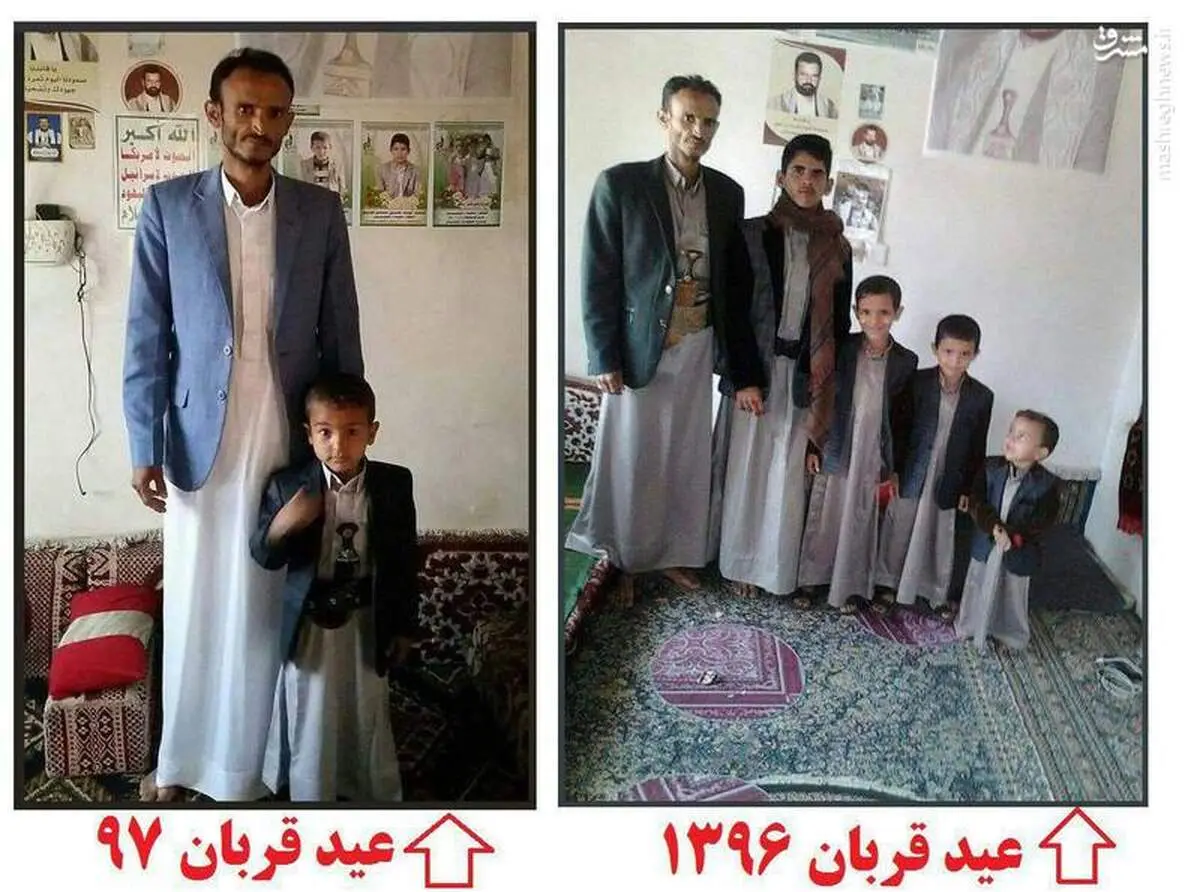 تصویری دردناک از عید قربان امسال در یمن
