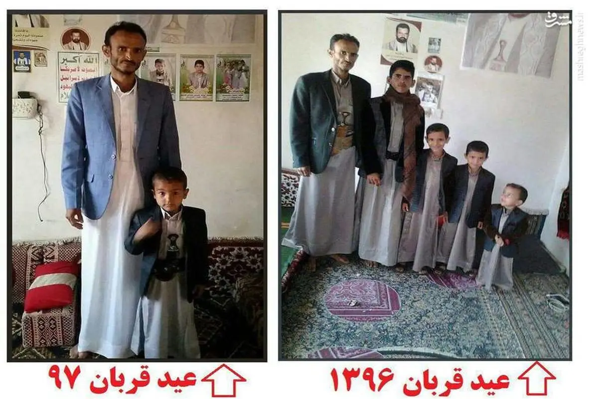 تصویری دردناک از عید قربان امسال در یمن