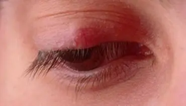 گل‌مژه را به هیچ وجه نترکانید