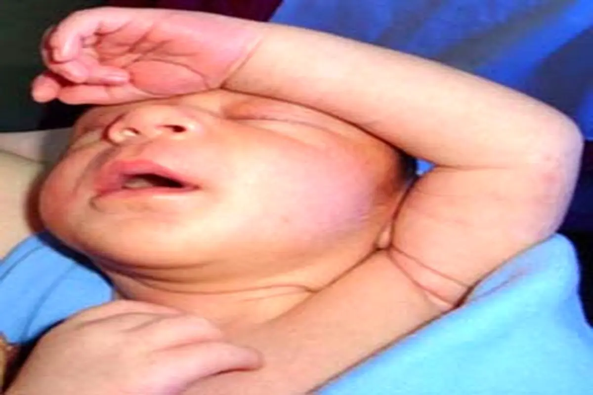 حقایقی درباره چشم های نوزادان