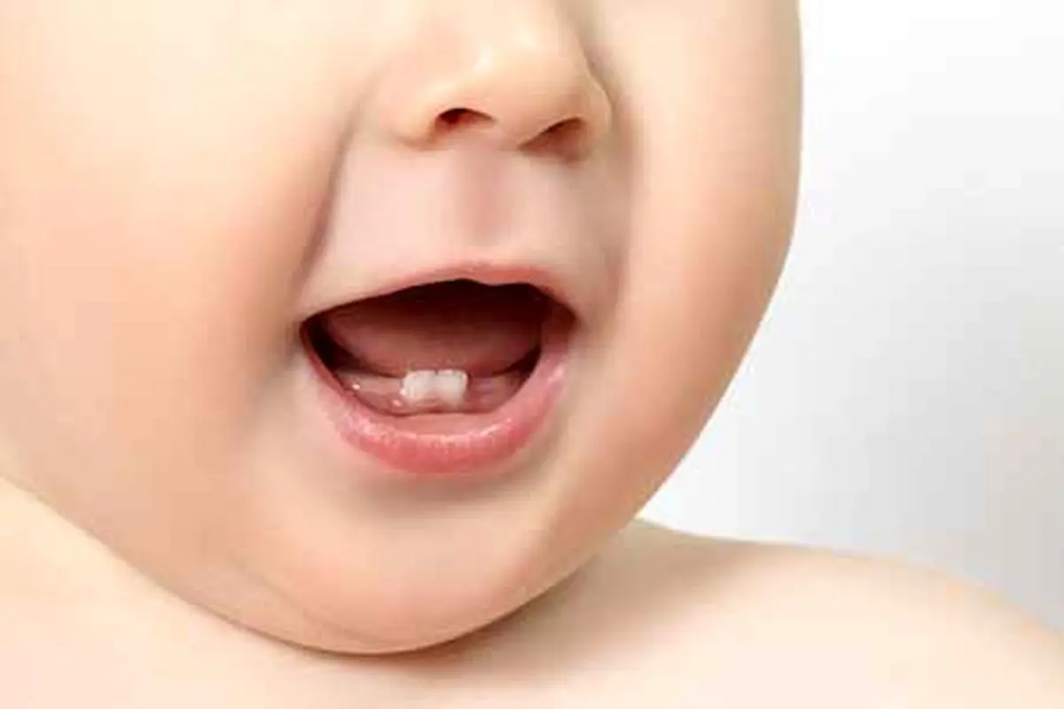 ﻿
آیا استفاده از ژل های بی حسی هنگام دندان در آوردن کودکان صحیح است؟
