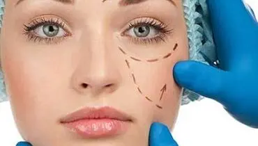 مراقب آبسه و عفونت بعد از پروتز گونه باشید!