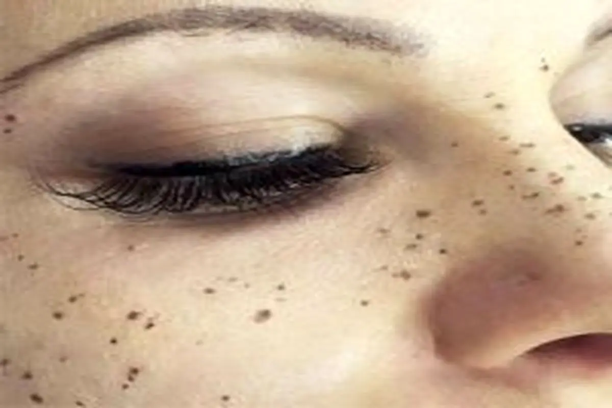 چرا دختران ایرانی، روی صورت‌شان کک مک تتو می‌کنند؟