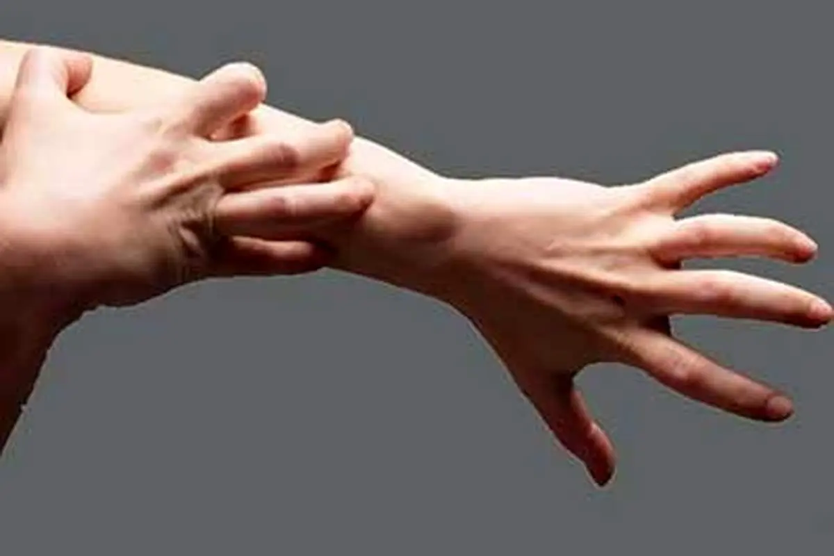 خارش پوست کلافهتان کرده؟