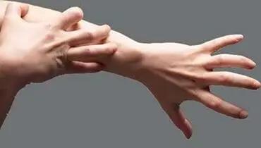 خارش پوست کلافه‌تان کرده؟