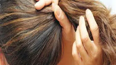 مو خوره چگونه به وجود می‌آید؟
