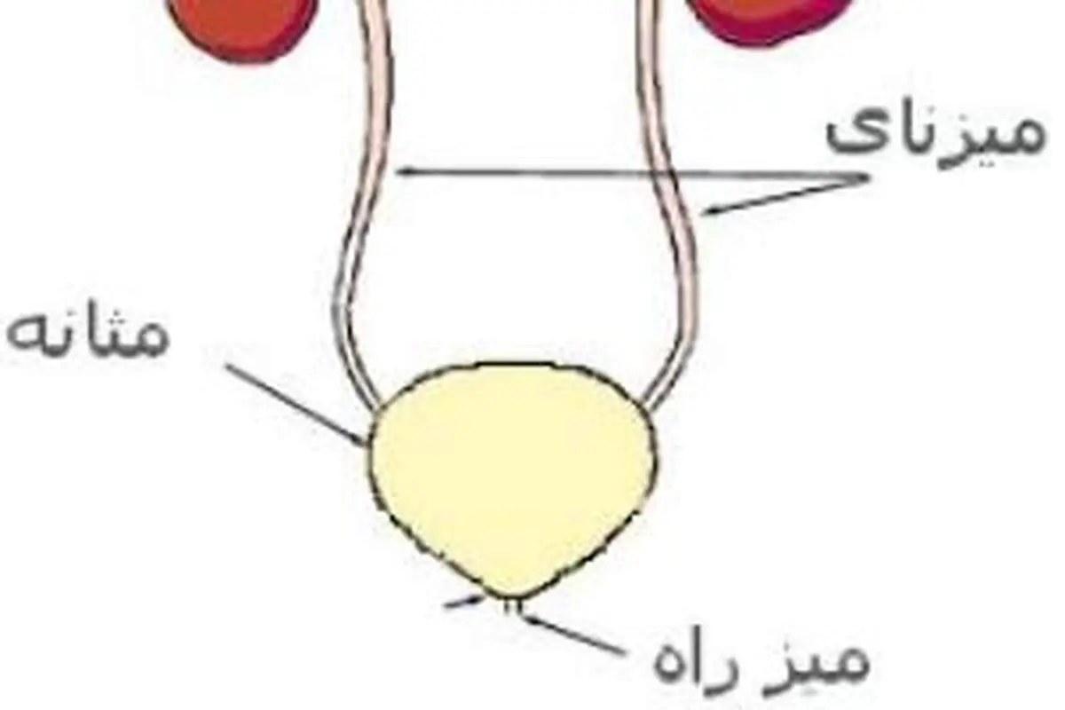 سوزش ادرار علامت چیست؟