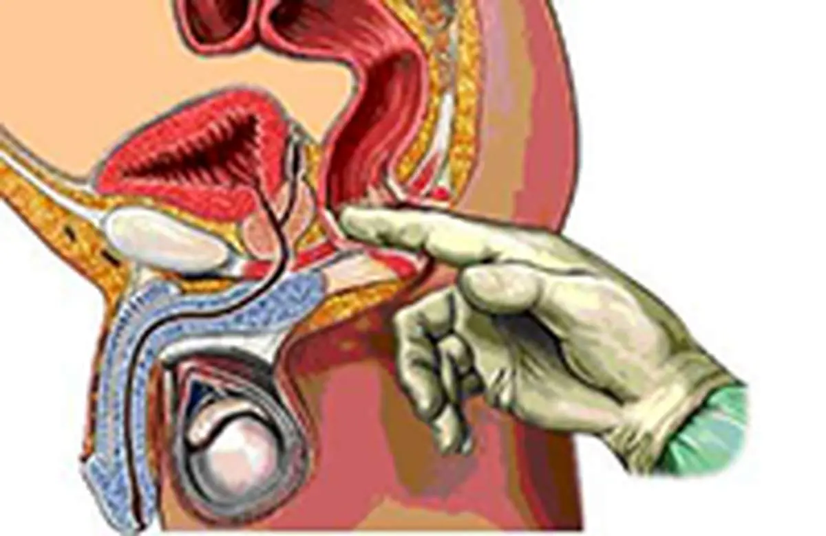 بواسیر و شقاق چیست؟