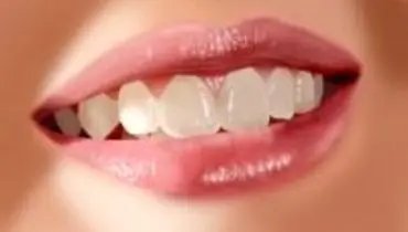 بهداشت دهان روی سلامت بدن چه تاثیری دارد؟