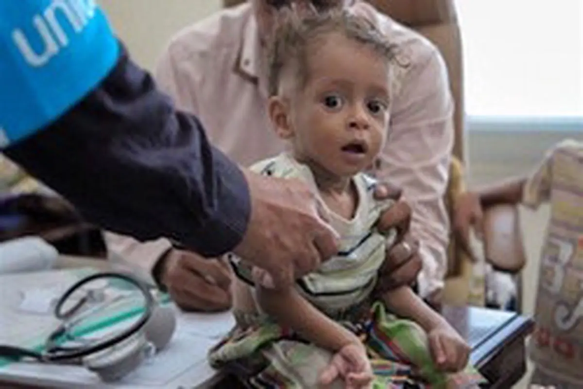 شیوع بیماری وبا در یمن بازهم قربانی گرفت