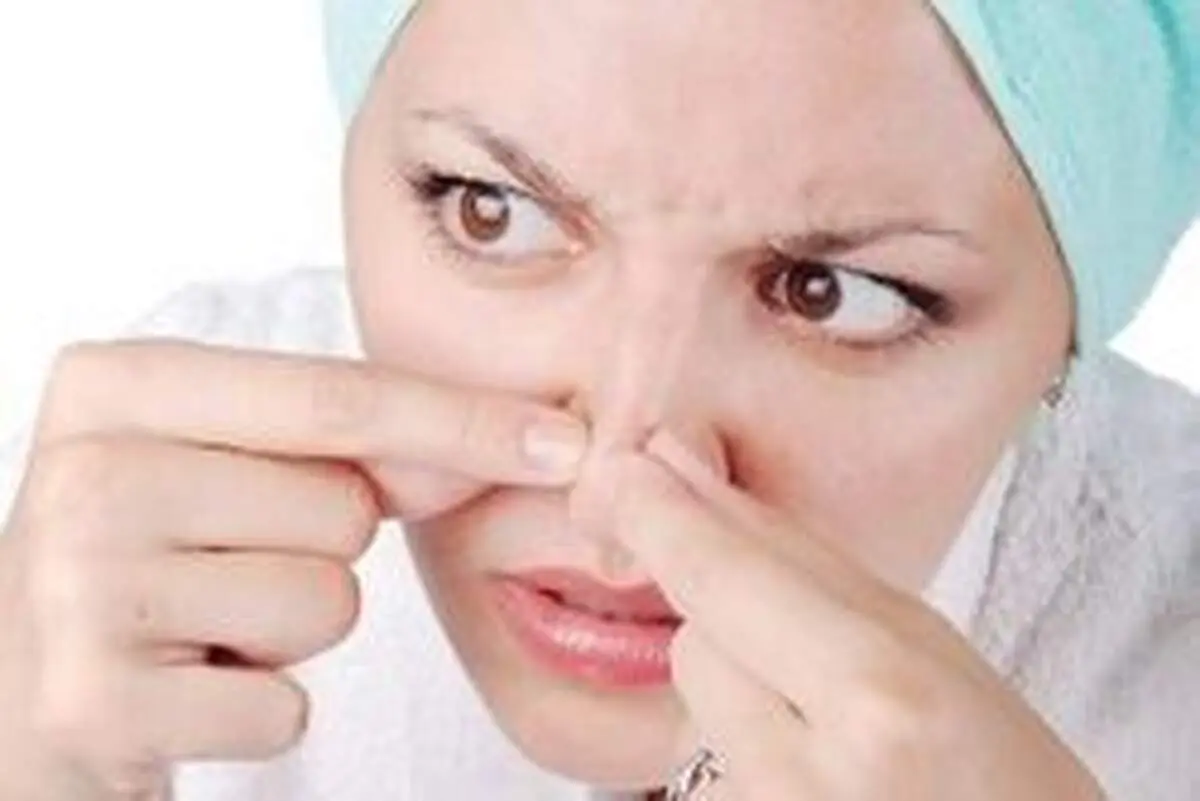 چگونه جوش سر سیاه روی بینی را از بین ببرم؟