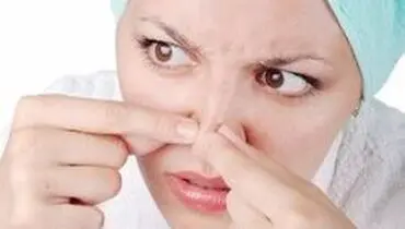 چگونه جوش سر سیاه روی بینی را از بین ببرم؟