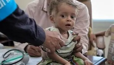 مرگ کودکان یمنی صدای نهادهای بین المللی را درآورد