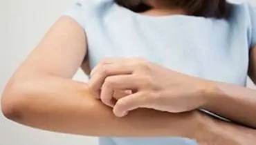 چند پیشنهاد موثر برای رفع تیرگی زانو و آرنج