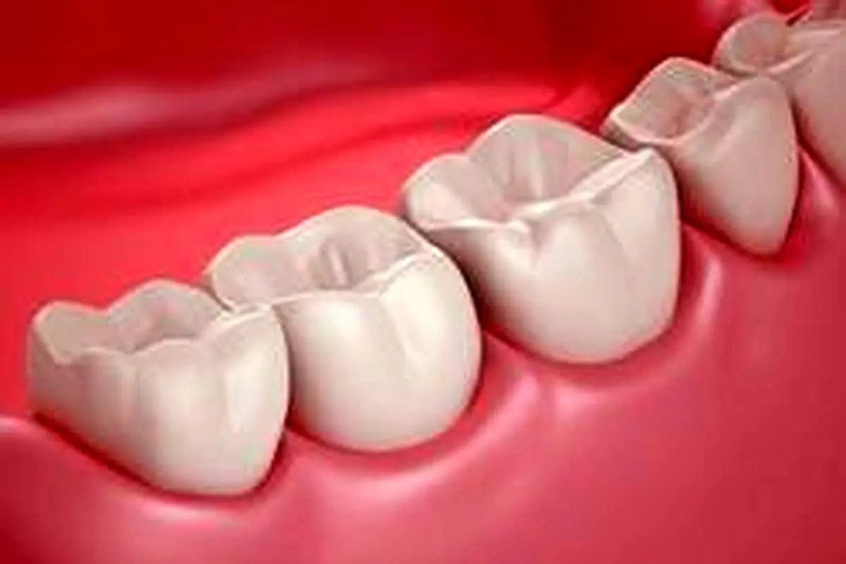 چگونه میتوان دندان مرده را زنده کرد؟
