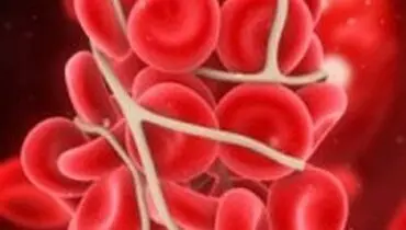 پیش‌بینی احتمال عود لوسمی با آزمایش دی ان‌ای