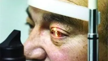 وقتی خبر بد باعث تبخال چشم می‌شود