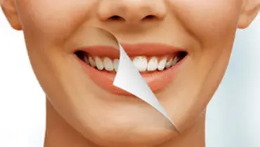 چگونه "جرم دندان" را از بین ببریم؟