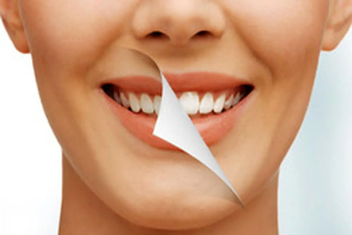 چگونه "جرم دندان" را از بین ببریم؟