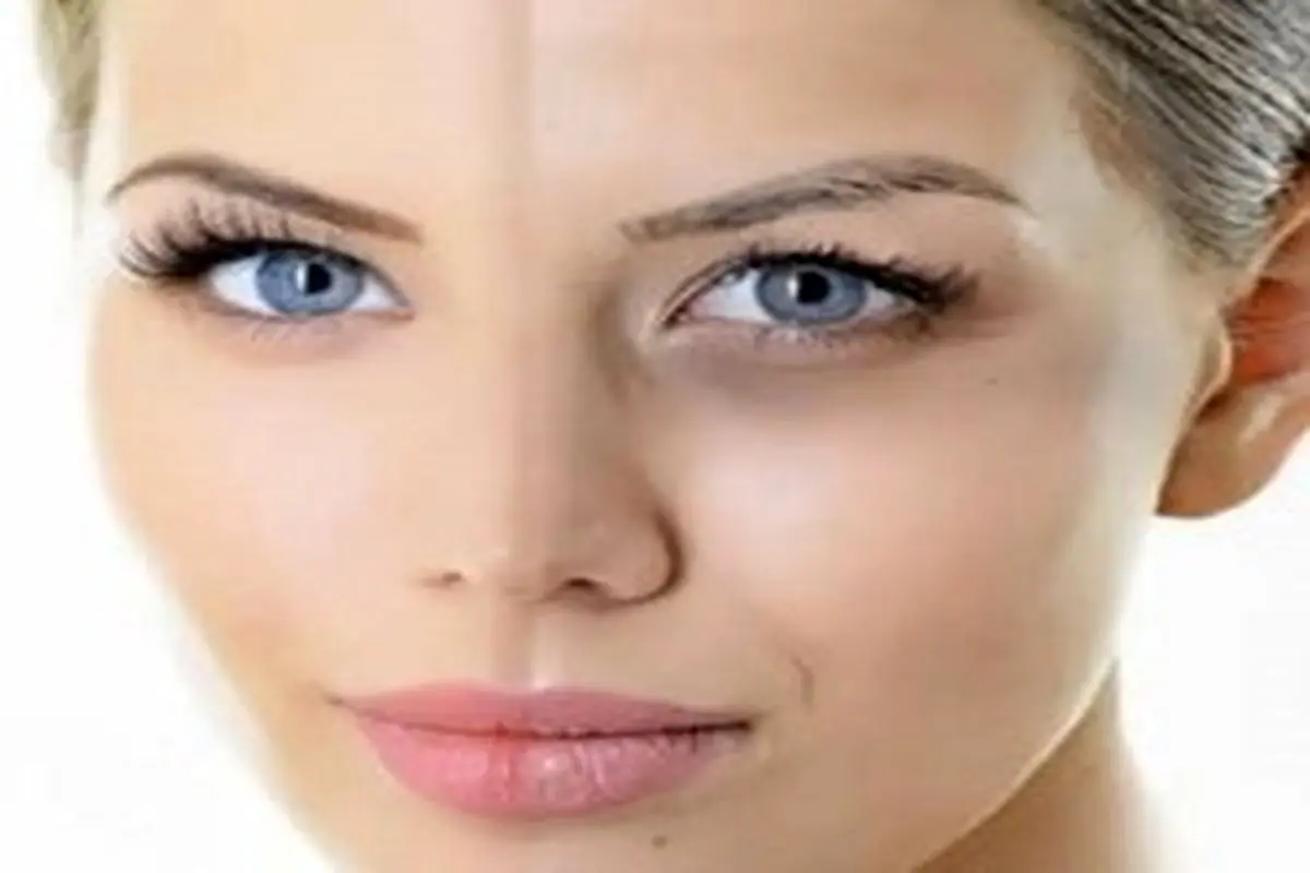 ۵ روش طبیعی و خانگی برای از بین بردن گودی کاسه چشم