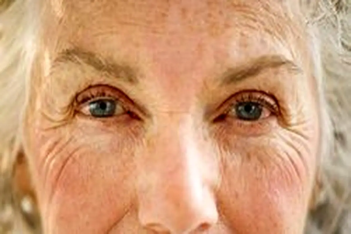 رابطه چین و چروکهای صورت با مشکلات سلامت
