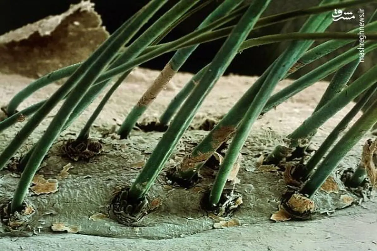 تصویری جالب از مژه انسان زیر میکروسکوپ