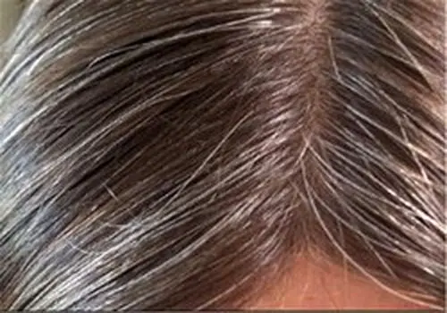  دلایل سفید شدن مو در کودکان