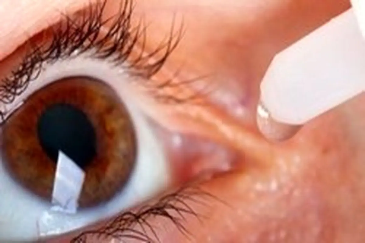 هشدار به مصرف خودسرانه قطره‌های چشمی نفازولین