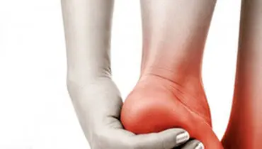 ۵ دلیل آسیب دیدگی پاشنه پا هنگام پیاده روی