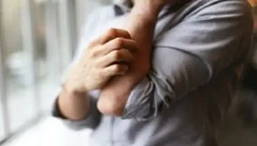 علامت خارش شدید پوست هنگام شب