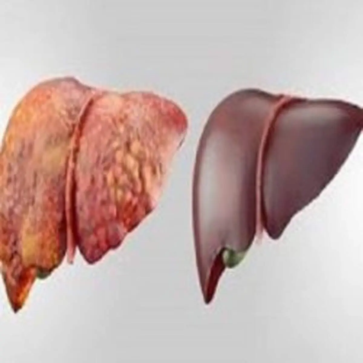 مراقب چربی خون و چاقی باشیم