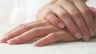 از بین بردن کاشت ناخن
