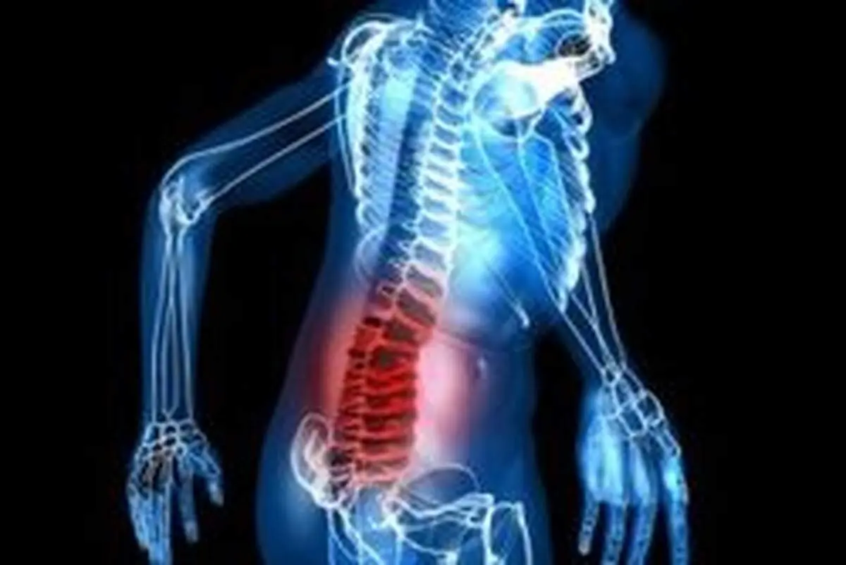 راهی برای پیشگیری از گودی کمر