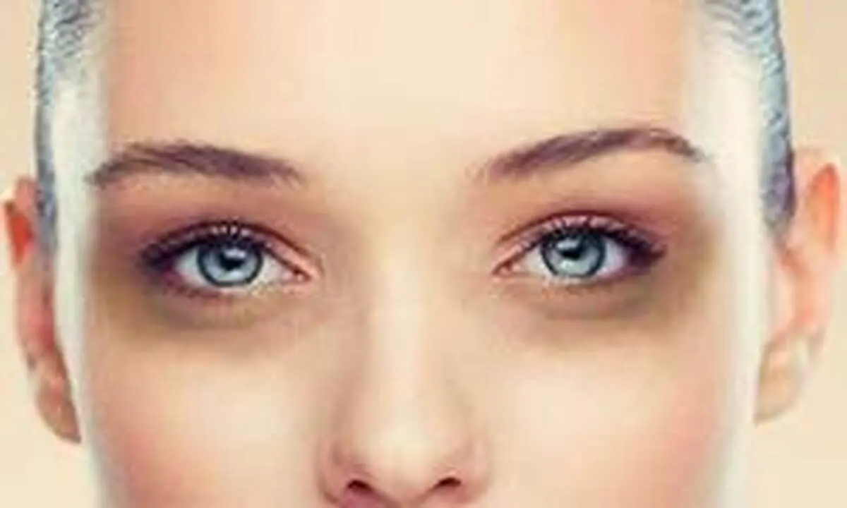 کبودی زیر چشمم را چگونه با آرایش از بین ببرم؟