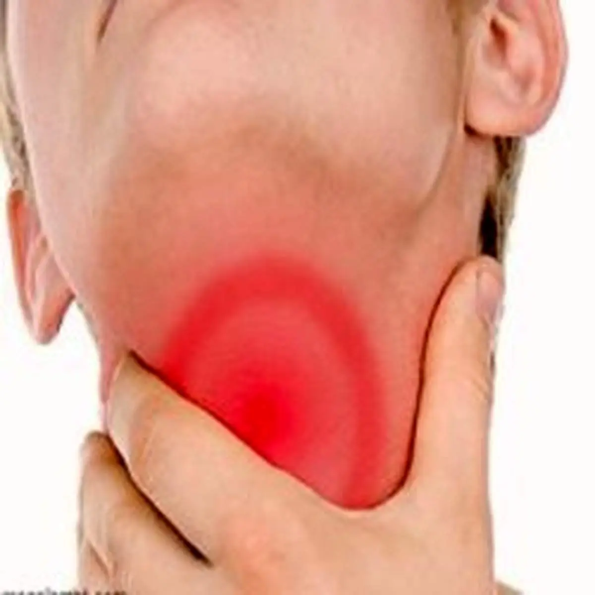 عفونت لوزه‌ها چه بیماری‌هایی را در پی دارد؟