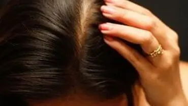 از شپش و مشکلات آن چه میدانید؟