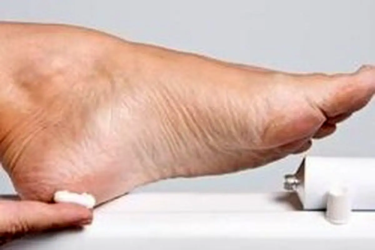 نقش ناخن انگشتان پا در سرطان ریه