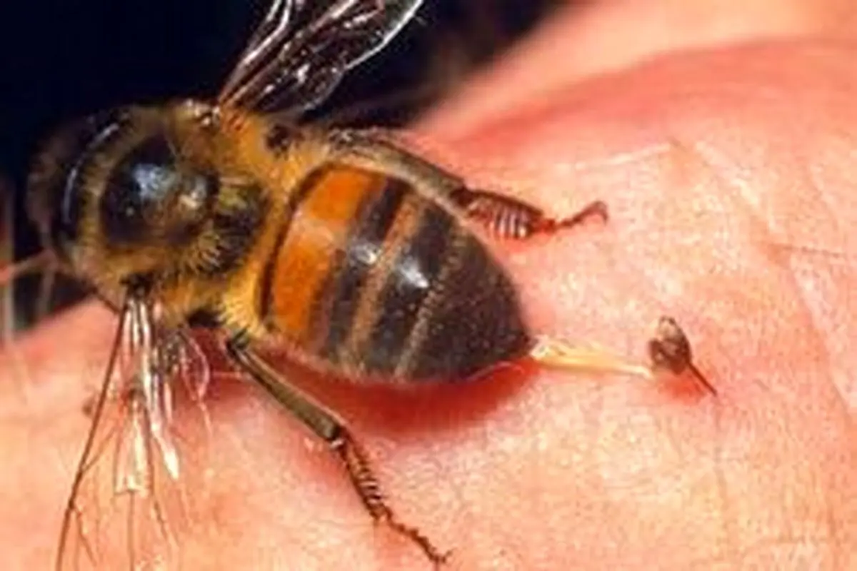 راهی برای درمان زنبور گزیدگی