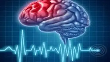 ۶ راهکار ساده برای جلوگیری از سکته مغزی