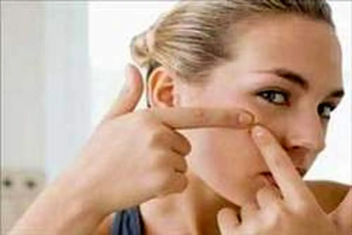 چرا پوست صورتم جوش می زند؟