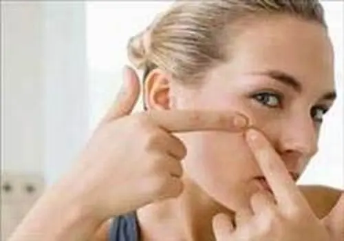 چی بخوریم جوش نزنیم؟/ ویدئو